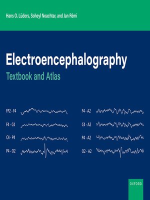 cover image of Electroencephalography